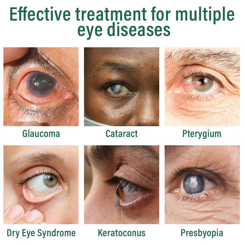 Nano Eye Drops Serum 👩‍⚕️Suitable for presbyopia, dry eye syndrome, glaucoma, and cataracts 🦘