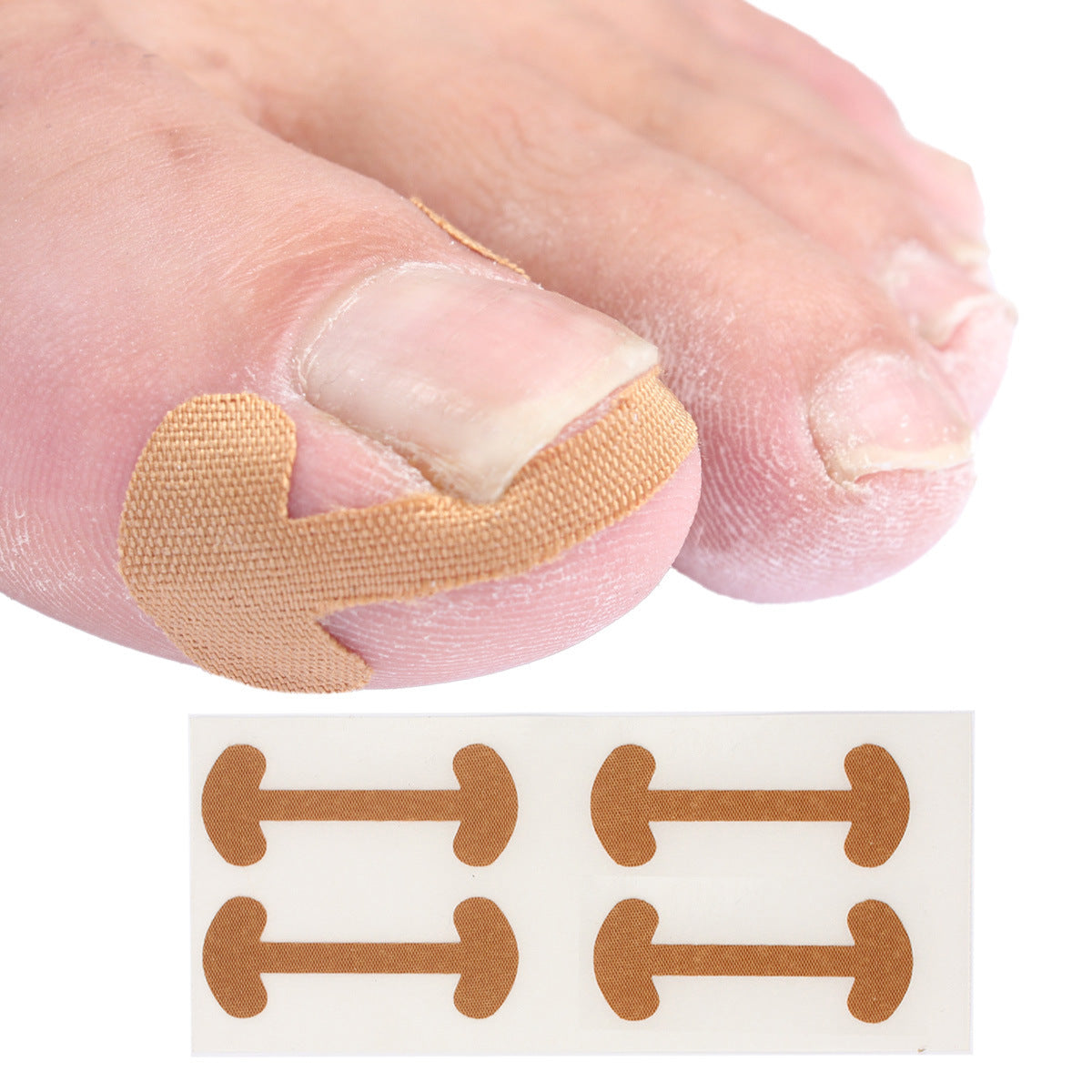 🔥🔥【Two Pieces Set】|  Ingrown Toenails Correction Patch & Nail groove air cushion