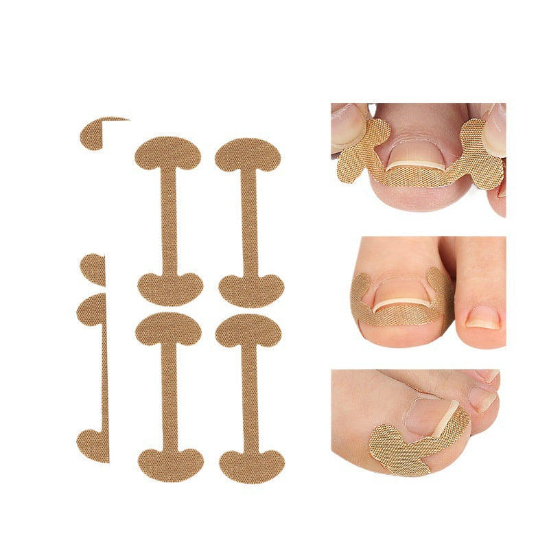 🔥🔥【Two Pieces Set】|  Ingrown Toenails Correction Patch & Nail groove air cushion