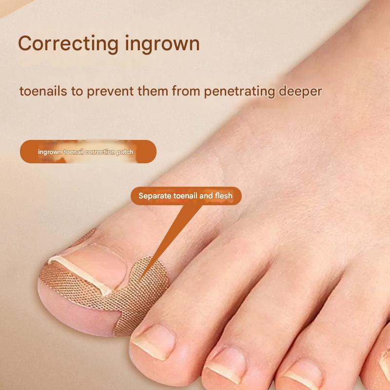 🔥🔥【Two Pieces Set】|  Ingrown Toenails Correction Patch & Nail groove air cushion